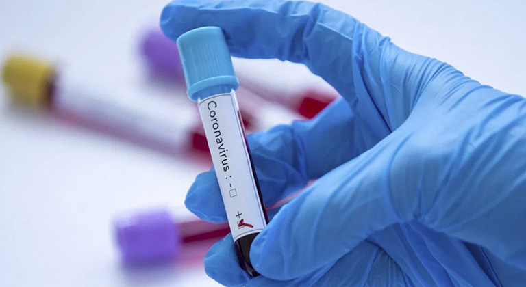 Çekya’da ilk Koronavirüs vakaları tespit edildi
