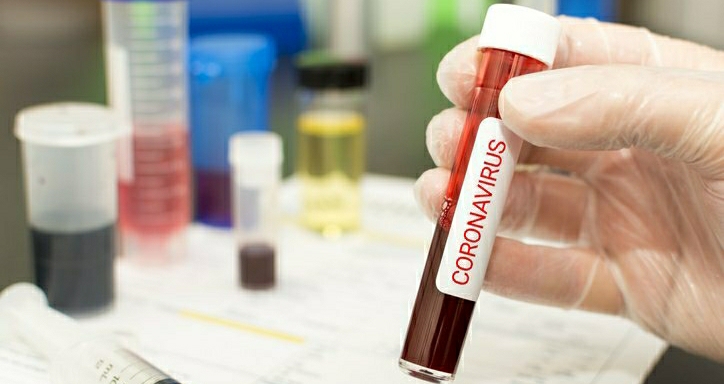 Dünya Genelinde Coronavirüse Yakalananların Sayısı 48 Milyona Yaklaştı