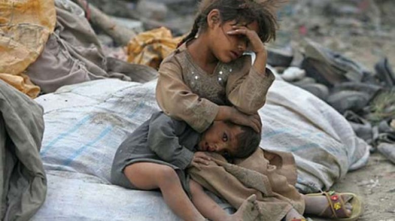 Yemen’de Açlıktan; 100 Bin Çocuk Ölebilir!